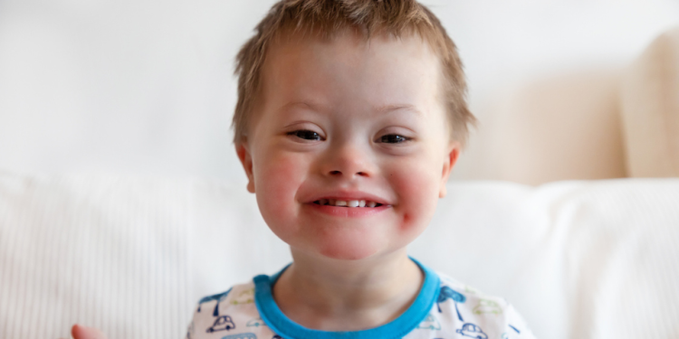 down syndrome cure