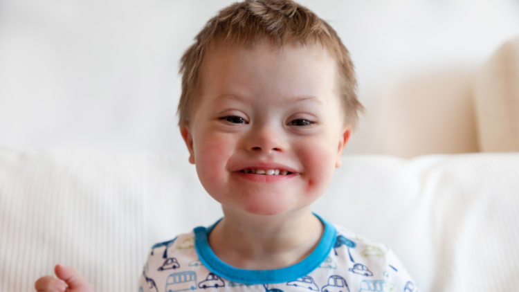 down syndrome cure