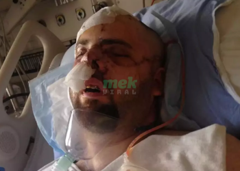 bear attack survivor