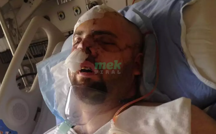 bear attack survivor